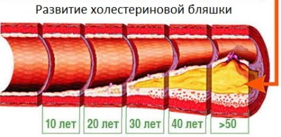 Холестерин