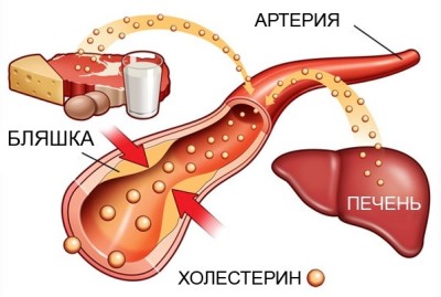 Холестерин